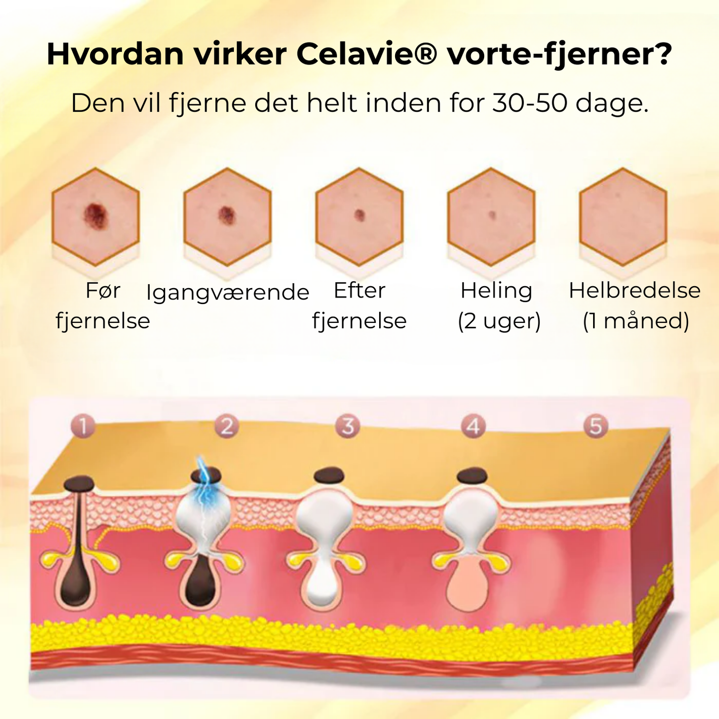 Celavie® | 48% af de adspurgte rapporterede en betydelig forbedring af udseendet af modermærker, vorter og andre hudlidelser