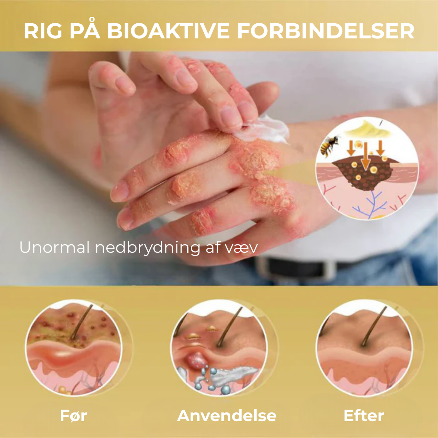 Celavie® | 48% af de adspurgte rapporterede en betydelig forbedring af udseendet af modermærker, vorter og andre hudlidelser