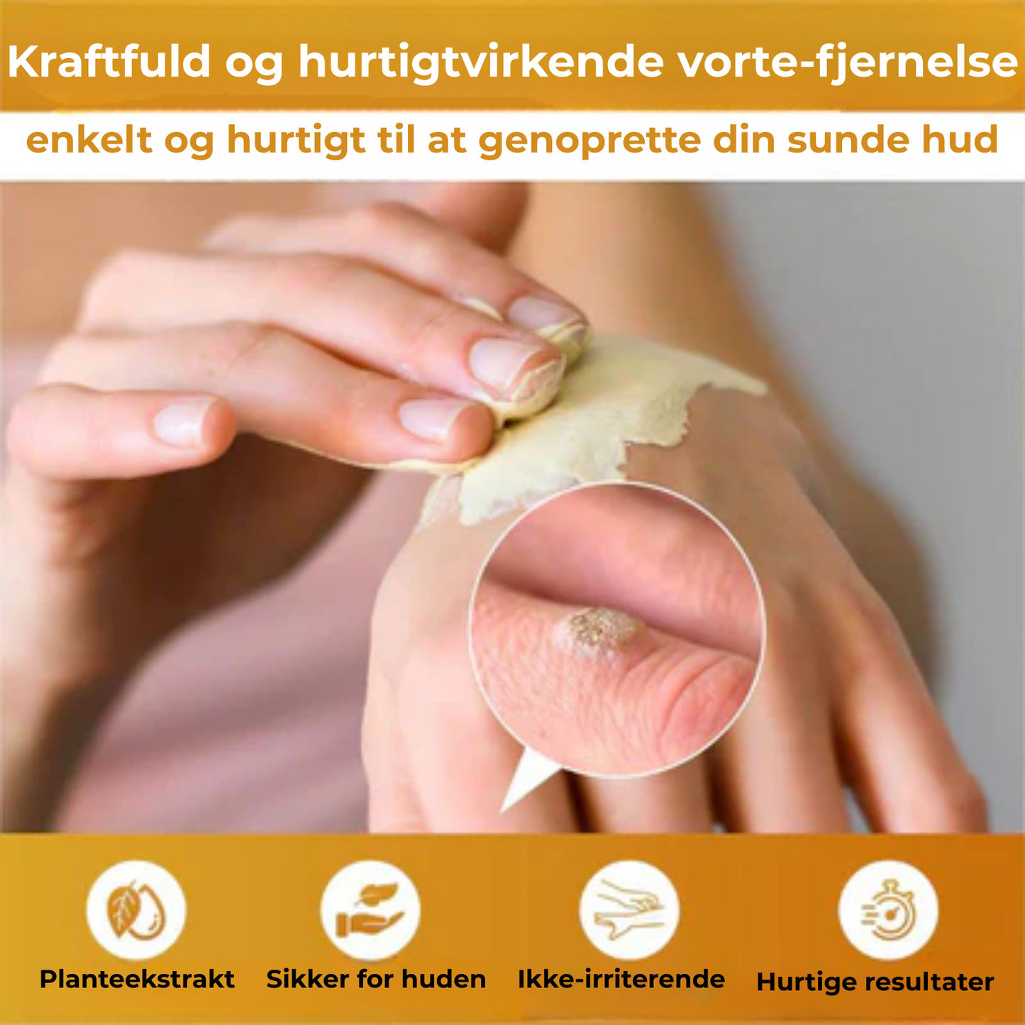 Celavie® | 48% af de adspurgte rapporterede en betydelig forbedring af udseendet af modermærker, vorter og andre hudlidelser