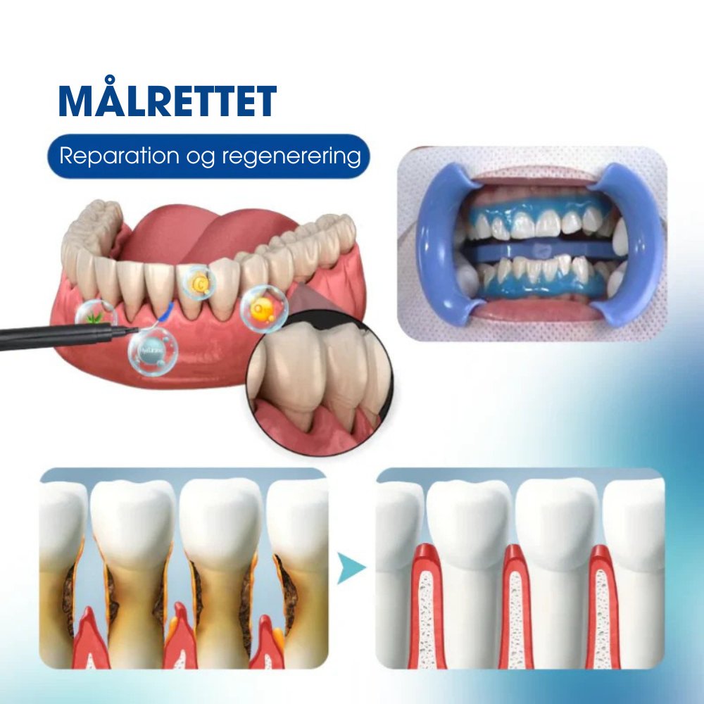 Auradent® | Forestil dig at kunne smile med selvtillid hver gang