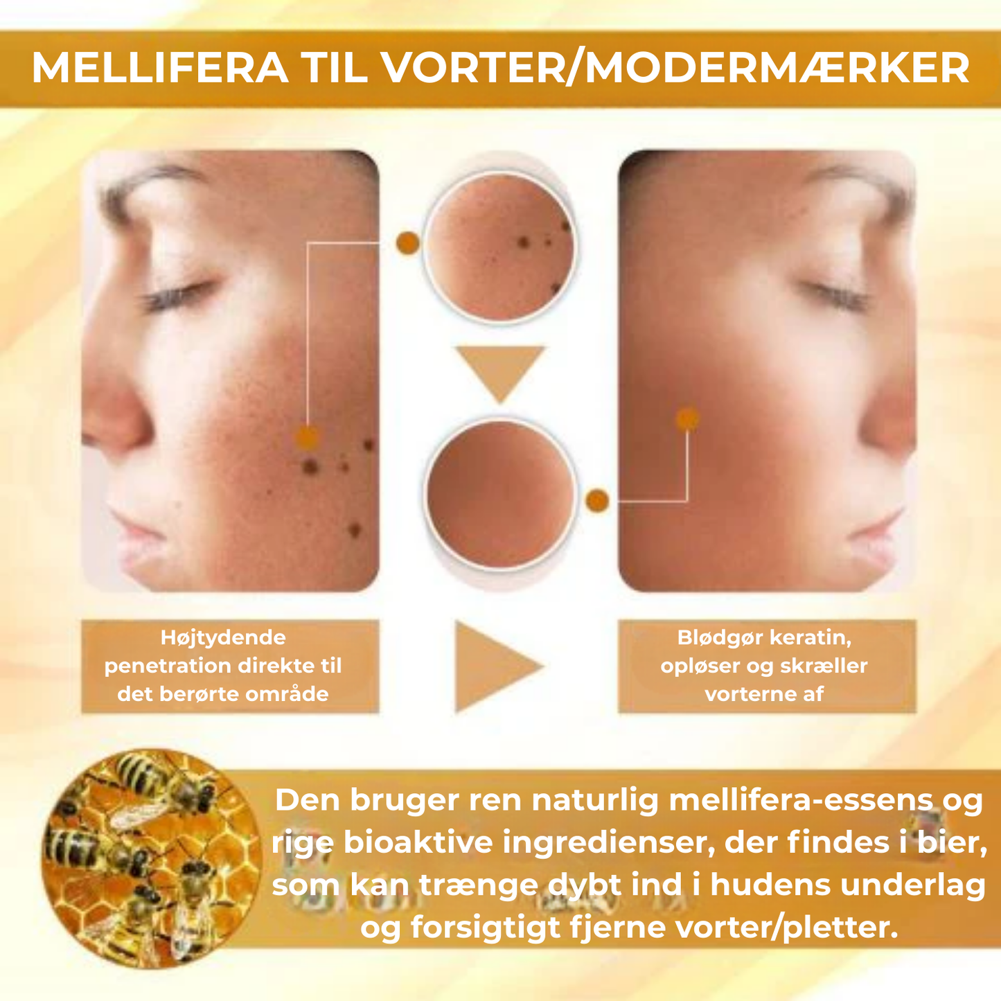 Celavie® | 48% af de adspurgte rapporterede en betydelig forbedring af udseendet af modermærker, vorter og andre hudlidelser