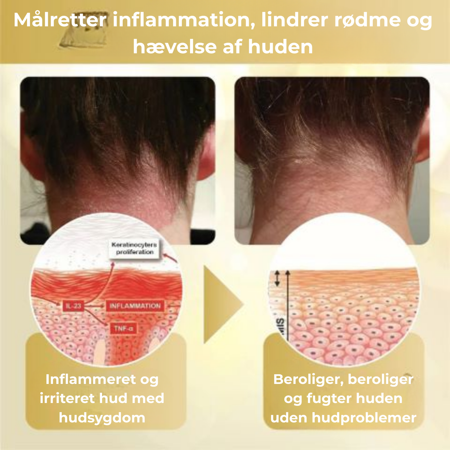 Celavie® | 48% af de adspurgte rapporterede en betydelig forbedring af udseendet af modermærker, vorter og andre hudlidelser