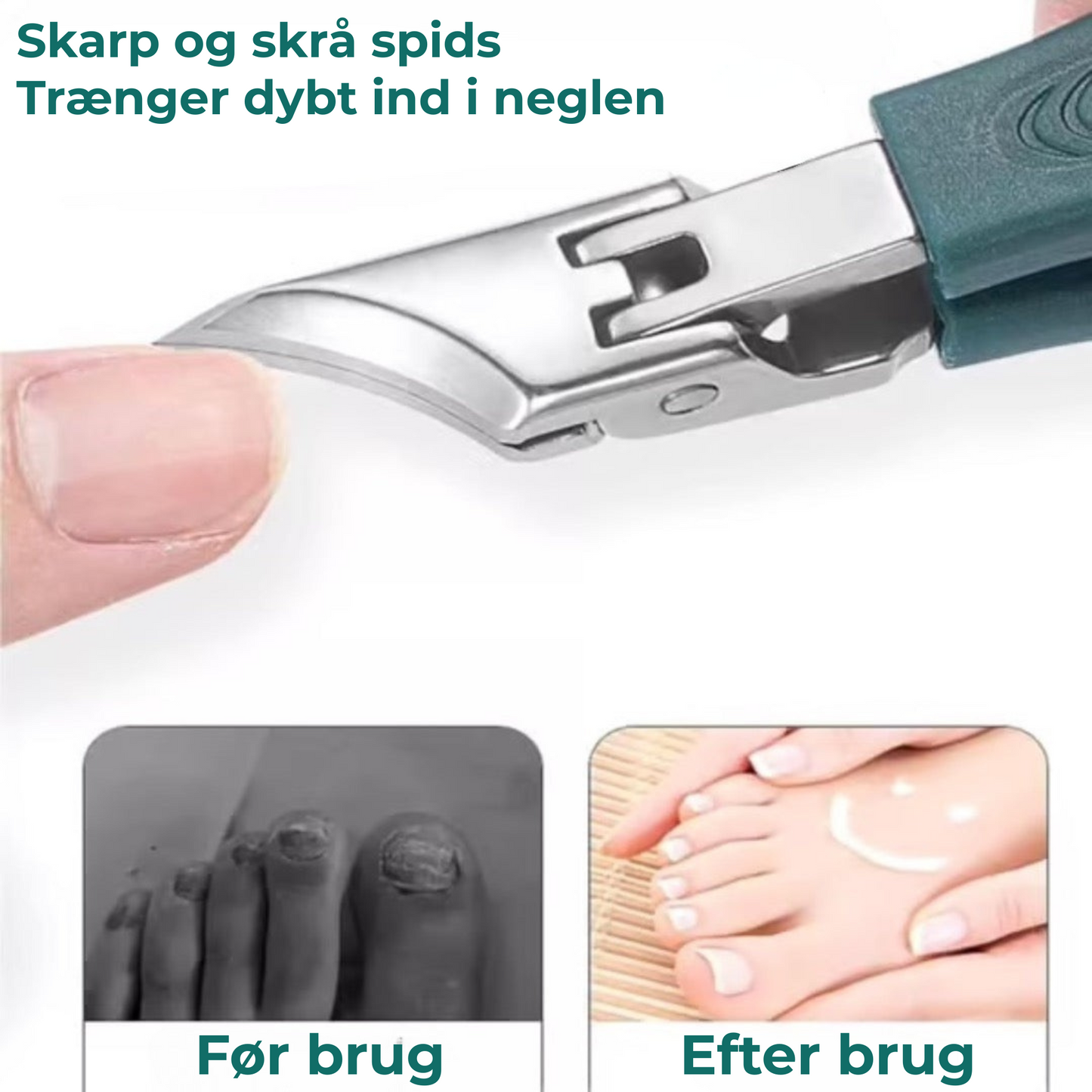 ClipPack® | Selv til de mest følsomme negle