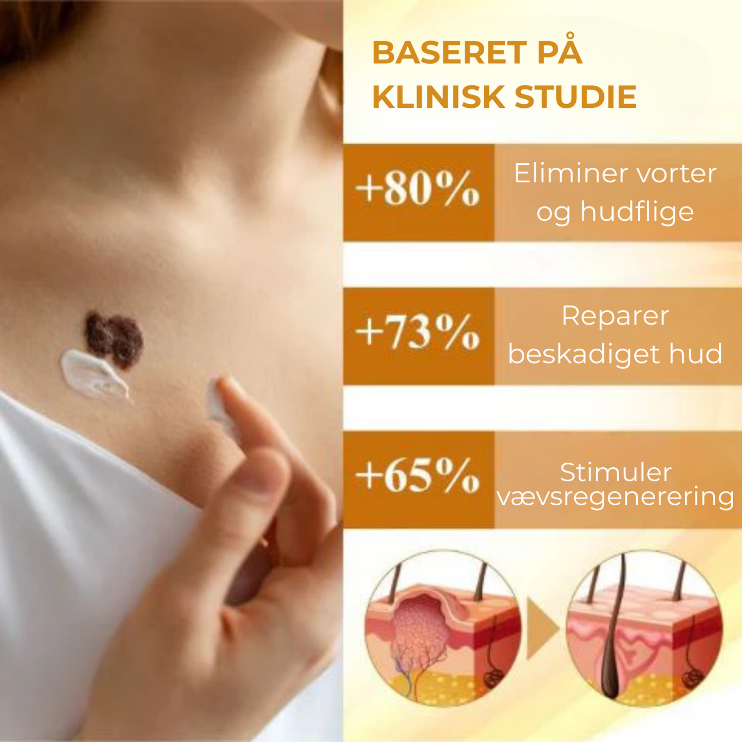 Celavie® | 48% af de adspurgte rapporterede en betydelig forbedring af udseendet af modermærker, vorter og andre hudlidelser