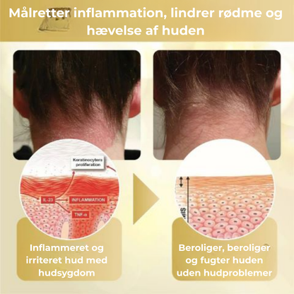 Celavie® | 48% af de adspurgte rapporterede en betydelig forbedring af udseendet af modermærker, vorter og andre hudlidelser