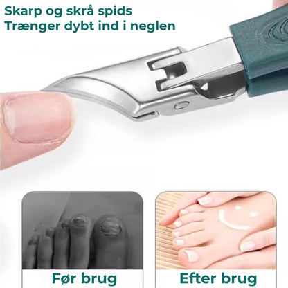 ClipPack® | Selv til de mest følsomme negle